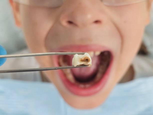 Best Emergency Root Canal Treatment in Marlboro Meadows, MD